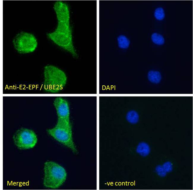UBE2S / E2 EPF Antibody - E2-EPF / UBE2S Antibody Immunofluorescence analysis of paraformaldehyde fixed A431 cells, permeabilized with 0.15% Triton. Primary incubation 1hr (10ug/ml) followed by Alexa Fluor 488 secondary antibody (2ug/ml), showing cytoplasmic and nuclear staining. The nuclear stain is DAPI (blue). Negative control: Unimmunized goat IgG (10ug/ml) followed by Alexa Fluor 488 secondary antibody (2ug/ml).