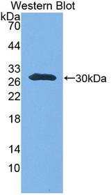 UBE2S / E2 EPF Antibody - Western Blot; Sample: Recombinant protein.