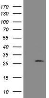 UBE2S / E2 EPF Antibody - HEK293T cells were transfected with the pCMV6-ENTRY control (Left lane) or pCMV6-ENTRY UBE2S (Right lane) cDNA for 48 hrs and lysed. Equivalent amounts of cell lysates (5 ug per lane) were separated by SDS-PAGE and immunoblotted with anti-UBE2S.