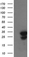 UBE2S / E2 EPF Antibody - HEK293T cells were transfected with the pCMV6-ENTRY control (Left lane) or pCMV6-ENTRY UBE2S (Right lane) cDNA for 48 hrs and lysed. Equivalent amounts of cell lysates (5 ug per lane) were separated by SDS-PAGE and immunoblotted with anti-UBE2S.