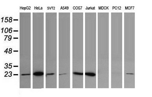 UBE2S / E2 EPF Antibody - Western blot of extracts (35ug) from 9 different cell lines by using anti-UBE2S monoclonal antibody (HepG2: human; HeLa: human; SVT2: mouse; A549: human; COS7: monkey; Jurkat: human; MDCK: canine; PC12: rat; MCF7: human).