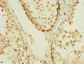 UBE2S / E2 EPF Antibody - Immunohistochemistry of paraffin-embedded human testis tissue at dilution 1:100