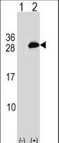 UBE2T / HSPC150 Antibody - Western blot of UBE2T (arrow) using rabbit polyclonal UBE2T Antibody. 293 cell lysates (2 ug/lane) either nontransfected (Lane 1) or transiently transfected (Lane 2) with the UBE2T gene.