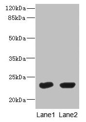UBE2T / HSPC150 Antibody - Western Blot All lanes: UBE2T antibody at 10µg/ml Lane 1: HepG2 whole cell lysate Lane 2: Hela whole cell lysate Secondary Goat polyclonal to rabbit IgG at 1/10000 dilution Predicted band size: 23 kDa Observed band size: 23 kDa