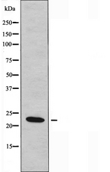 UBE2T / HSPC150 Antibody - Western blot analysis of extracts of HeLa cells using UBE2T antibody.