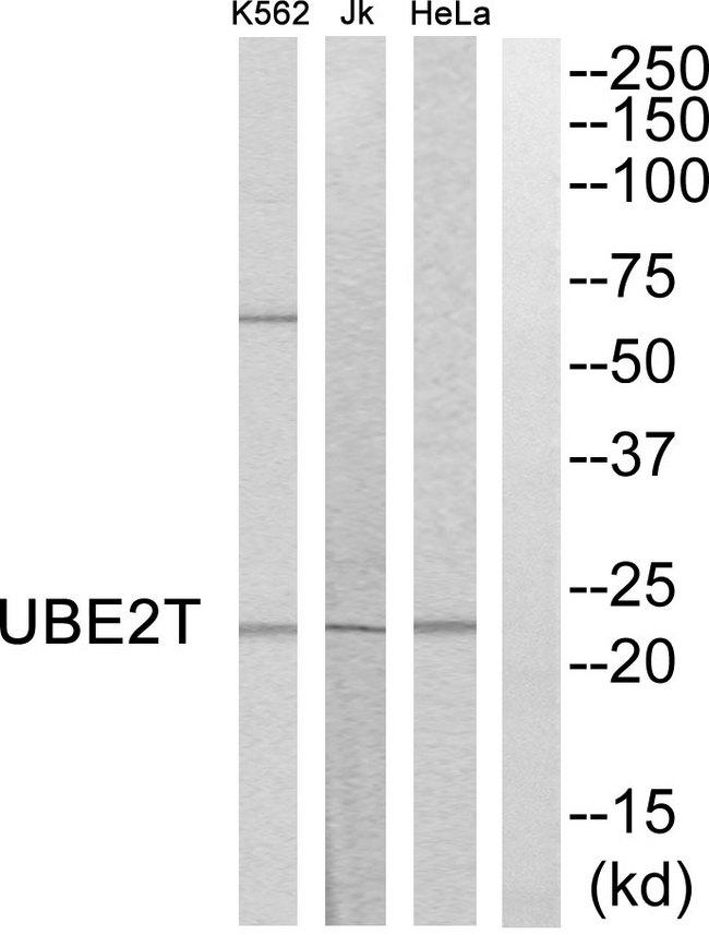 UBE2T / HSPC150 Antibody - Western blot analysis of extracts from HeLa cells, Jurkat cells and K562 cells, using UBE2T antibody.