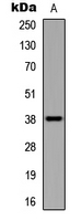 UBE2U Antibody - Western blot analysis of UBE2U expression in HEK293T (A) whole cell lysates.