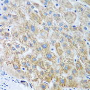 UBE2U Antibody - Immunohistochemistry of paraffin-embedded human liver tissue.