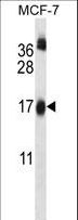 UBE2W Antibody - UBE2W Antibody western blot of MCF-7 cell line lysates (35 ug/lane). The UBE2W antibody detected the UBE2W protein (arrow).