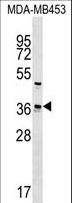 UBE2Z / USE1 Antibody - UBE2Z Antibody western blot of MDA-MB453 cell line lysates (35 ug/lane). The UBE2Z antibody detected the UBE2Z protein (arrow).
