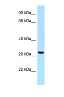 UBE2Z / USE1 Antibody - UBE2Z antibody Western blot of HepG2 Cell lysate. Antibody concentration 1 ug/ml.  This image was taken for the unconjugated form of this product. Other forms have not been tested.