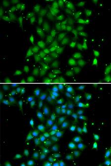 UBE2Z / USE1 Antibody - Immunofluorescence analysis of MCF7 cells.