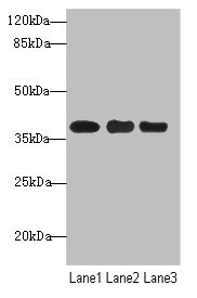 UBE2Z / USE1 Antibody - Western blot All Lanes: UBE2Z antibody at 1.68ug/ml Lane 1: MCF7 whole cell lysate Lane 2: HepG-2 whole cell lysate Lane 3: Hela whole cell lysate Secondary Goat polyclonal to Rabbit IgG at 1/10000 dilution Predicted band size: 39,29 kDa Observed band size: 38 kDa