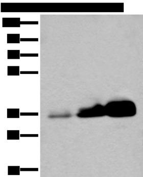 UBE2Z / USE1 Antibody - Western blot analysis of Human testis tissue NIH/3T3 and 231 cell lysates  using UBE2Z Polyclonal Antibody at dilution of 1:350