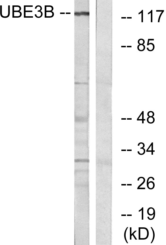 UBE3B Antibody - Western blot analysis of lysates from Jurkat cells, using UBE3B Antibody. The lane on the right is blocked with the synthesized peptide.