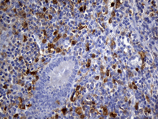 UBE3B Antibody - Immunohistochemical staining of paraffin-embedded Human appendix tissue within the normal limits using anti-UBE3B mouse monoclonal antibody. (Heat-induced epitope retrieval by 1mM EDTA in 10mM Tris buffer. (pH8.5) at 120°C for 3 min. (1:250)