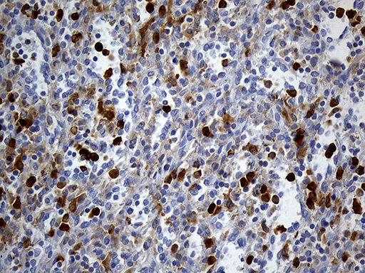 UBE3B Antibody - Immunohistochemical staining of paraffin-embedded Human spleen tissue within the normal limits using anti-UBE3B mouse monoclonal antibody. (Heat-induced epitope retrieval by 1mM EDTA in 10mM Tris buffer. (pH8.5) at 120°C for 3 min. (1:250)