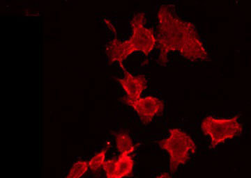 UBE3B Antibody - Staining HeLa cells by IF/ICC. The samples were fixed with PFA and permeabilized in 0.1% Triton X-100, then blocked in 10% serum for 45 min at 25°C. The primary antibody was diluted at 1:200 and incubated with the sample for 1 hour at 37°C. An Alexa Fluor 594 conjugated goat anti-rabbit IgG (H+L) Ab, diluted at 1/600, was used as the secondary antibody.