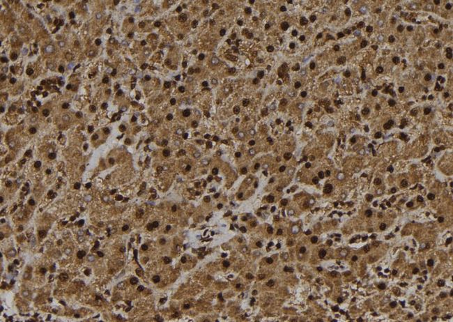 UBE3B Antibody - 1:100 staining human liver tissue by IHC-P. The sample was formaldehyde fixed and a heat mediated antigen retrieval step in citrate buffer was performed. The sample was then blocked and incubated with the antibody for 1.5 hours at 22°C. An HRP conjugated goat anti-rabbit antibody was used as the secondary.