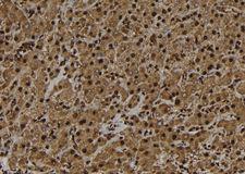 UBE3B Antibody - 1:100 staining human liver tissue by IHC-P. The sample was formaldehyde fixed and a heat mediated antigen retrieval step in citrate buffer was performed. The sample was then blocked and incubated with the antibody for 1.5 hours at 22°C. An HRP conjugated goat anti-rabbit antibody was used as the secondary.