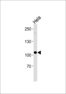 UBE3C Antibody - UBE3C Antibody western blot of HeLa cell line lysates (35 ug/lane). The UBE3C antibody detected the UBE3C protein (arrow).