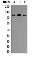UBE3C Antibody - Western blot analysis of UBE3C expression in HeLa (A); HepG2 (B); THP1 (C) whole cell lysates.