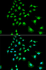 UBE3C Antibody - Immunofluorescence analysis of U2OS cells.