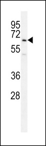 UBFD1 Antibody - UBFD1 Antibody western blot of HepG2 cell line lysates (35 ug/lane). The UBFD1 antibody detected the UBFD1 protein (arrow).