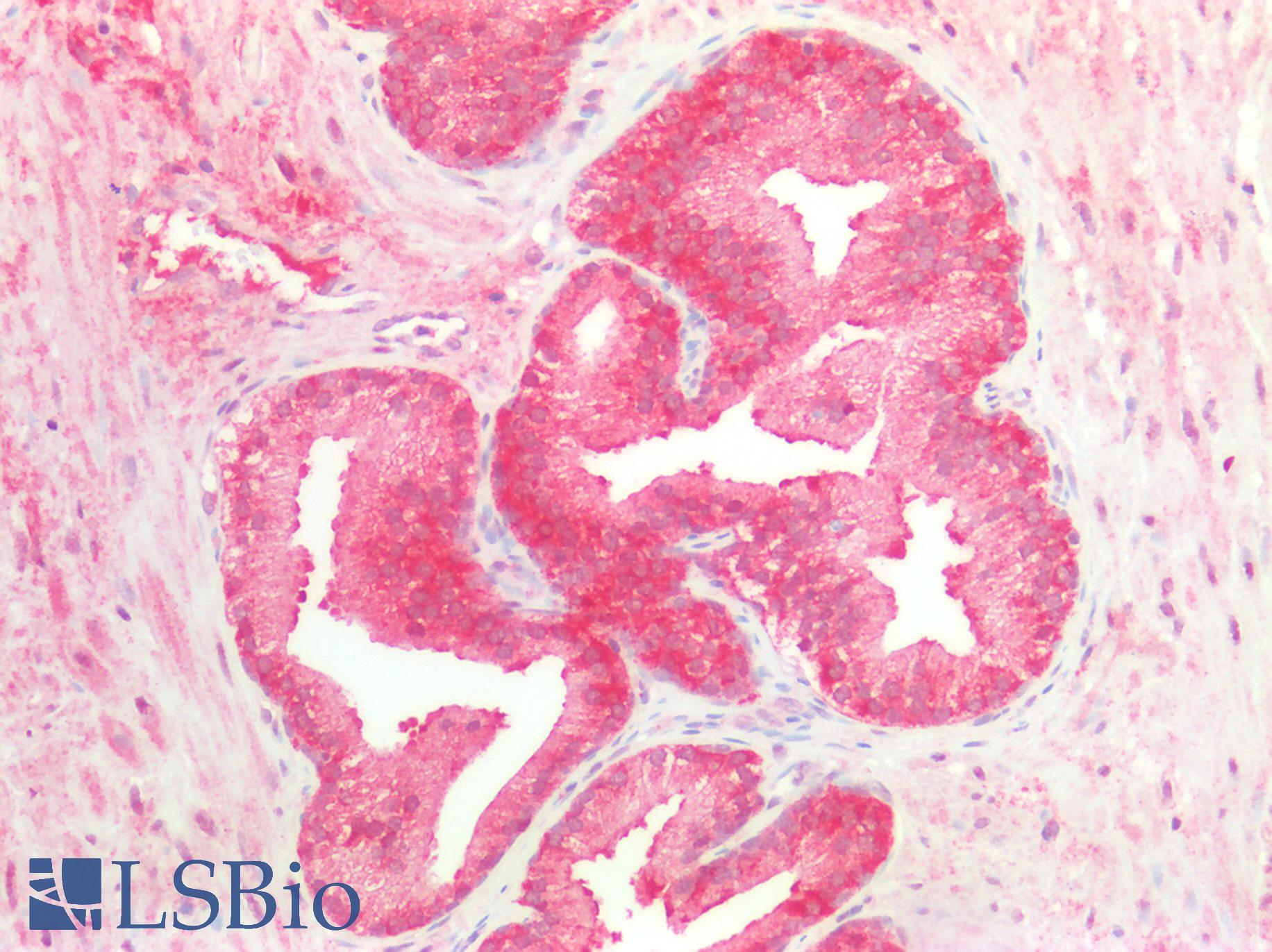 Anti-Ubiquilin 2 / UBQLN2 Antibody | Rabbit anti-Human Polyclonal