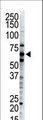 Ubiquilin 2 / UBQLN2 Antibody - The anti-Dsk2 antibody is used in Western blot to detect Dsk2 in HeLa cell lysate.