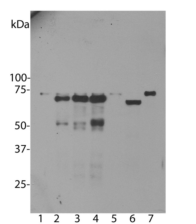 Ubiquilin 2 / UBQLN2 Antibody - Western blot analysis of untransfected primary mouse neuron and glia cell cultures (lane 1), the same cells transduced with human ubiquilin 2 wild type (lane 2), with ubiquilin 2 P506T mutant (lane 3), with ubiquilin 2 P497S mutant (lane 4) and with enhanced GFP control (lane 5), all probed with Ubiquilin 2 / UBQLN2 antibody. Also seen is Ubiquilin 2 / UBQLN2 antibody staining in HeLa cells (lane 6) and 3T3 cells (lane 7). In primary mouse neuron and glia cell culture, endogenous ubiquilin 2 appears as a weak band at 68 kDa in all transduced and non-transduced cells, indicating low endogenous expression of mouse ubiquilin 2. Strong bands are seen in the cells transduced with human wild type or mutant ubiquilin 2. Small proteins run at 50 kDa in these cells are the fragments of ubiquilin 2. Note, ubiquilin 2 run at ~66 kDa in human HeLa cells and 68 kDa in rodent 3T3 cells.
