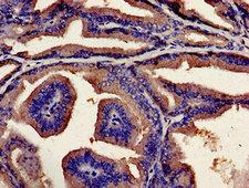 Ubiquilin 2 / UBQLN2 Antibody - Immunohistochemistry analysis of human prostate tissue at a dilution of 1:100