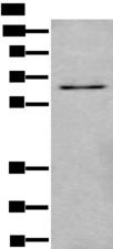 Ubiquilin 2 / UBQLN2 Antibody - Western blot analysis of SKOV3 cell lysate  using UBQLN2 Polyclonal Antibody at dilution of 1:500