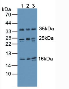 Ubiquitin Antibody - Western Blot; Sample. Lane1: Human Lung Tissue; Lane2: Human Hela Cells; Lane3: Mouse Liver Tissue.