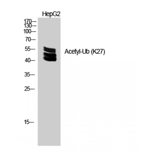 Ubiquitin Antibody - Western blot of Acetyl-Ub (K27) antibody