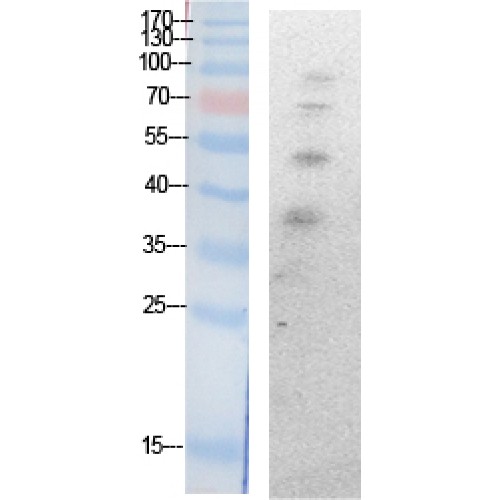 Ubiquitin Antibody - Western blot of Acetyl-Ub (K27) antibody
