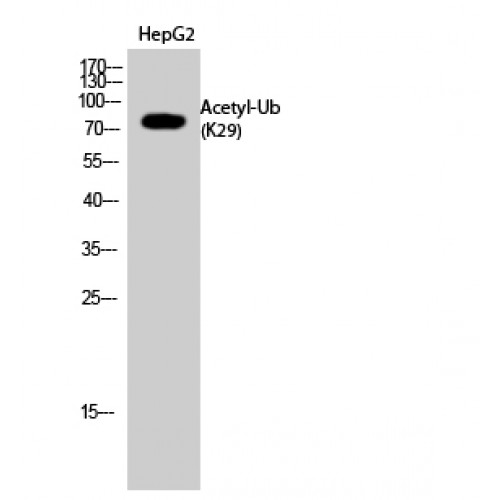 Ubiquitin Antibody - Western blot of Acetyl-Ub (K29) antibody