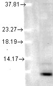 Ubiquitin Antibody - Ubiquitin (5B9-B3), in human cell lysates using a 1:1000 dilution.  This image was taken for the unconjugated form of this product. Other forms have not been tested.