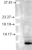Ubiquitin Antibody - Ubiquitin (6C11-B3), in human cell lines using a 1:1000 dilution.  This image was taken for the unconjugated form of this product. Other forms have not been tested.