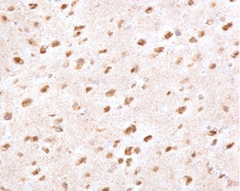 Ubiquitin Antibody - IHC staining of FFPE human brain with Ubiquitin antibody (clone PBQN-1). Required HIER: boil tissue sections in 10mM citrate buffer, pH 6, for 10-20 min followed by cooling at RT for 20 min.