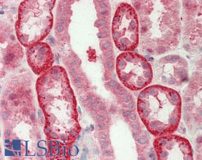 UBL5 Antibody - Human Kidney: Formalin-Fixed, Paraffin-Embedded (FFPE).  This image was taken for the unconjugated form of this product. Other forms have not been tested.