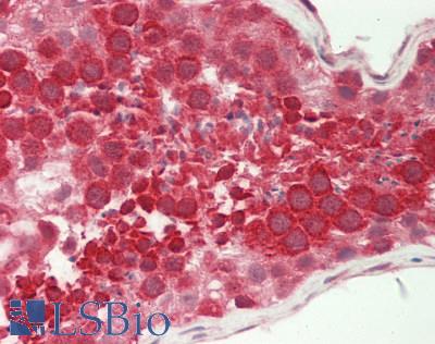UBL5 Antibody - Human Testis: Formalin-Fixed, Paraffin-Embedded (FFPE).  This image was taken for the unconjugated form of this product. Other forms have not been tested.