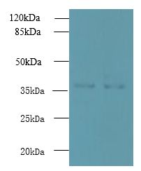 UBLCP1 Antibody - Western blot. All lanes: UBLCP1 antibody at 0.2 ug/ml. Lane 1: HeLa whole cell lysate. Lane 2: U251 whole cell lysate. Secondary Goat polyclonal to Rabbit IgG at 1:10000 dilution. Predicted band size: 37 kDa. Observed band size: 37 kDa.