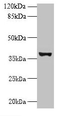 UBLCP1 Antibody - Western blot All lanes: UBLCP1 antibody at 0.2µg/ml + U251 whole cell lysate Secondary Goat polyclonal to rabbit IgG at 1/10000 dilution Predicted band size: 37 kDa Observed band size: 37 kDa