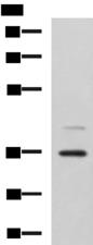 UBLCP1 Antibody - Western blot analysis of A172 cell lysate  using UBLCP1 Polyclonal Antibody at dilution of 1:1150