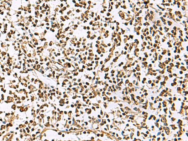 UBLCP1 Antibody - Immunohistochemistry of paraffin-embedded Human tonsil tissue  using UBLCP1 Polyclonal Antibody at dilution of 1:85(×200)