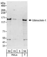 UBN1 / Ubinuclein 1 Antibody - Detection of Human Ubinuclein-1 by Western Blot. Samples: Whole cell lysate from HeLa (5, 15 and 50 ug for WB) and 293T (T; 50 ug) cells. Antibodies: Affinity purified rabbit anti-Ubinuclein-1 antibody used for WB at 0.1 ug/ml. Detection: Chemiluminescence with an exposure time of 3 minutes.