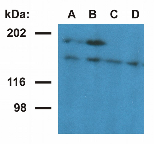 UBN1 / Ubinuclein 1 Antibody - Western blotting analysis of ubinuclein in nuclear fraction of HeLa cells. The monoclonal antibody UBN1-01 (lane A, B) detects ubinuclein 1 (165 kDa) and an 180 kDa protein - presumable ubinuclein 2. The antibody UBN1-02 (lane C, D) detects ubinuclein 1. Antibody dilution: A, C - 1 µg/ml; B, D - 5 µg/ml.