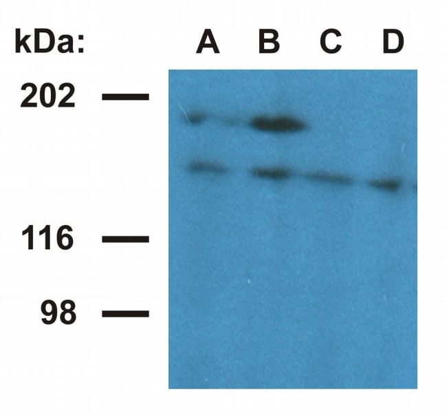 UBN1 / Ubinuclein 1 Antibody - Ubinuclein 1 Antibody in Western Blot (WB)