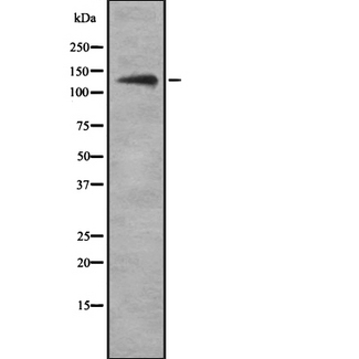 UBN1 / Ubinuclein 1 Antibody - Western blot analysis Ubinuclein using LOVO cells whole cells lysates